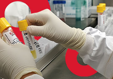 exame toxicológico cnh